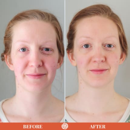 Minimal Photocentric Before and After Instagram Post-3
