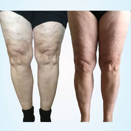 Deb-Before-&-After-Website