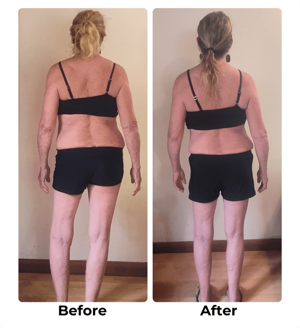Postural-Program-Before-After-L