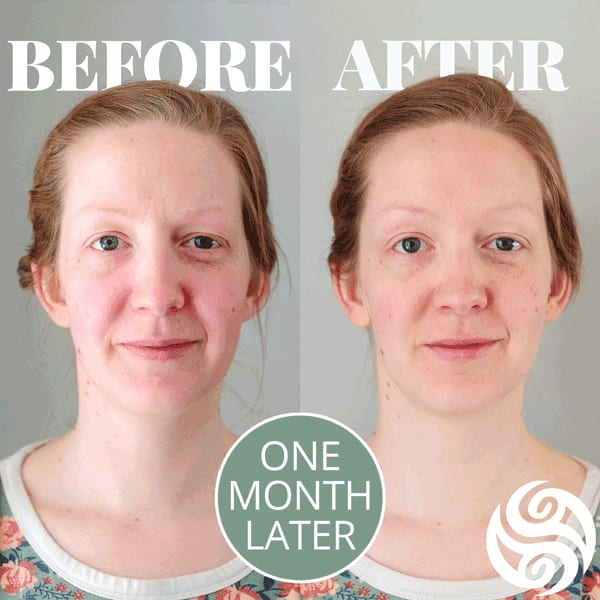 Erin Before and after Block Therapy Erin Before and after