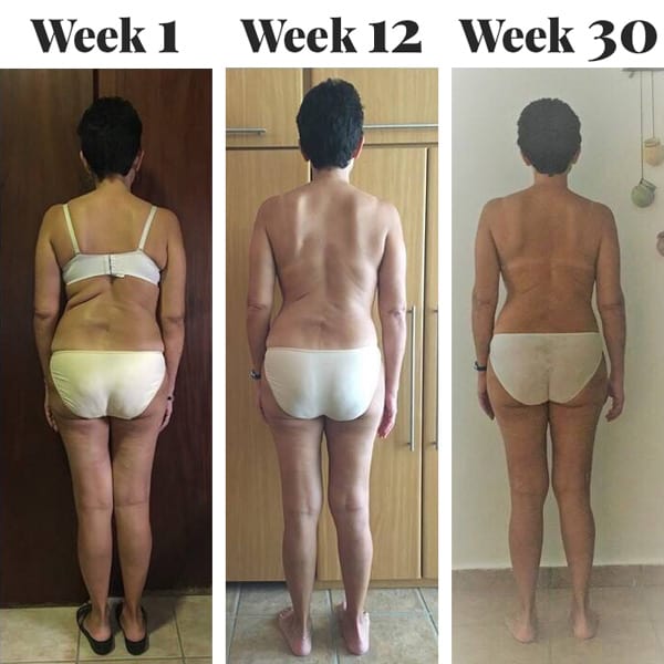 Edna's Scoliosis Progress