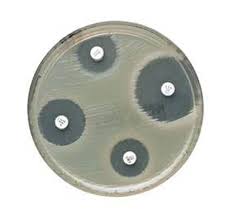 Oxoid™ Antimicrobial Susceptibility Disks