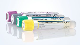 Quantiferon TB Gold Plus