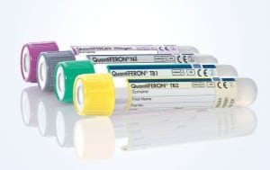 Quantiferon TB Gold Plus Quantiferon TB Gold Plus
