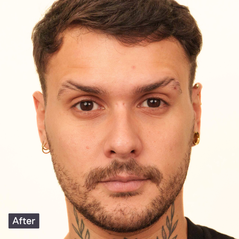 Man with dark hair, short beard, gold earrings and neck tattoo shown in an 'After' photo against white background.