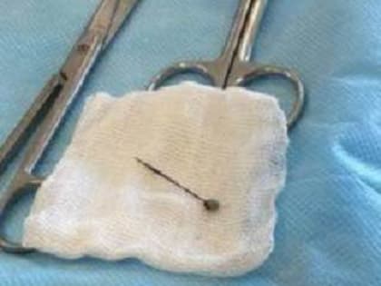 В Ростове-на-Дону медики прооперировали 11-летнего мальчика, который два года жил с иголкой в легком