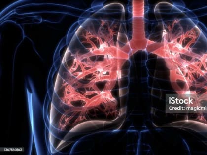 Рак легких: мифы и реальность