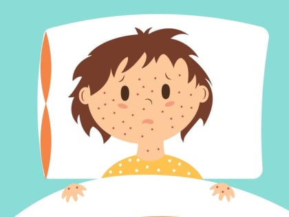 РОСПОТРЕБНАДЗОР ОЦЕНИЛ ВЕРОЯТНОСТЬ ЭПИДЕМИИ КОРИ В РФ