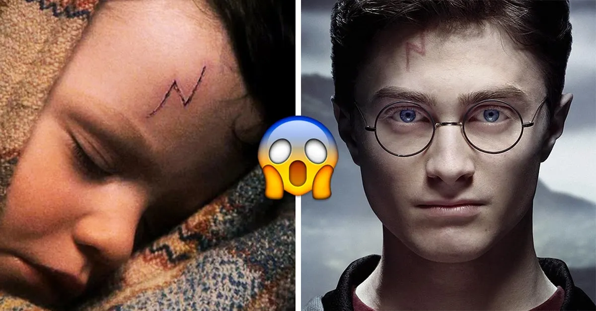 10 cosas sobre la cicatriz de Harry Potter que no tiene sentido, CHEKA