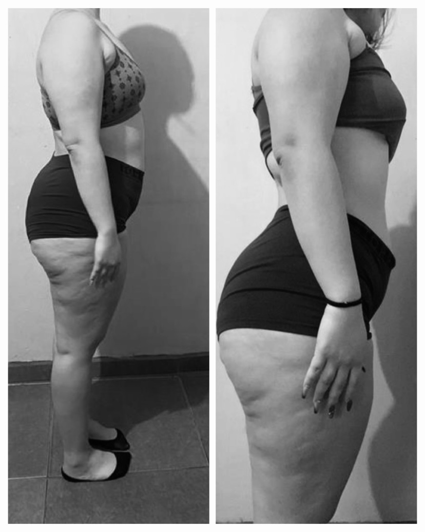 Transformation