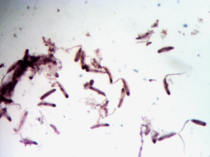 ЦЕРКАРИОЗ, ШИСТОСОМНЫЙ ДЕРМАТИТ ИЛИ «ЗУД КУПАЛЬЩИКОВ»