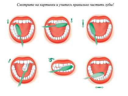 В Бурятии врач-стоматолог рассказала о профилактике кариеса у детей