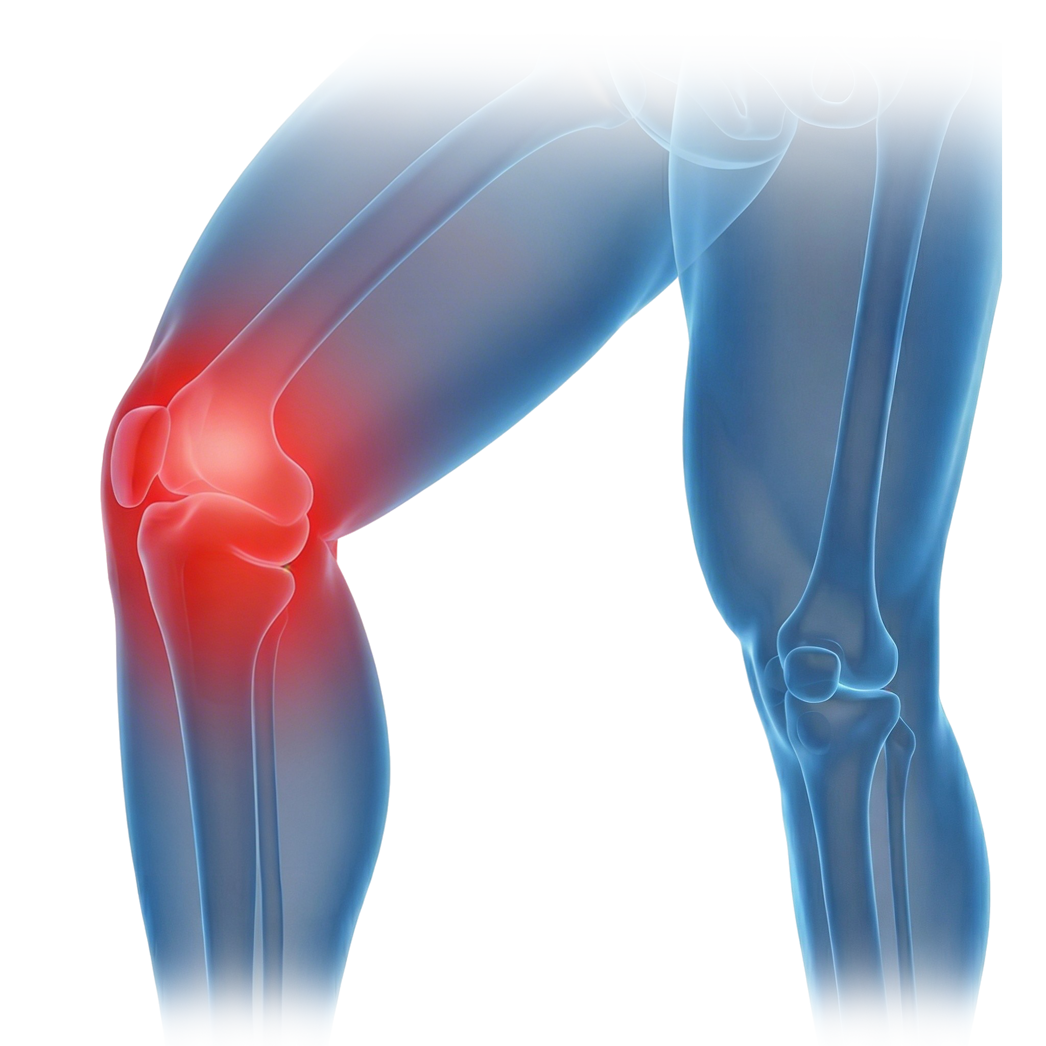 Knee pain