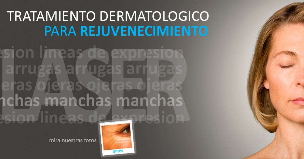 como quitar las ojeras, tratamiento para las arrugas, tratamientos laser de rejuvencimiento,