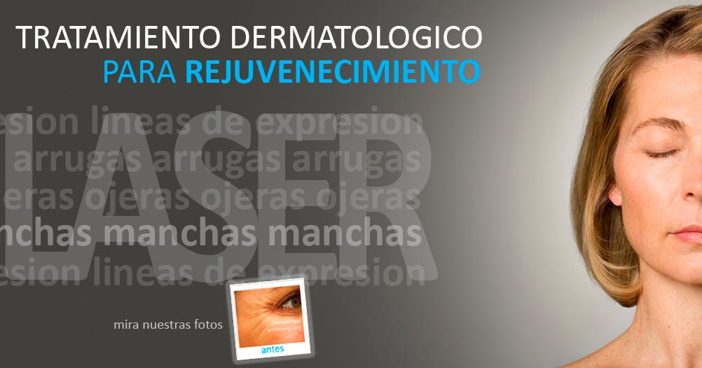 como quitar las ojeras, acido hialuronico, medicina estetica, lifting facial, arrugas en la cara, rejuvenecimiento, rejuvenece, como rejuvenecer la piel, tratamiento para las arrugas, tratamientos para las arrugas,