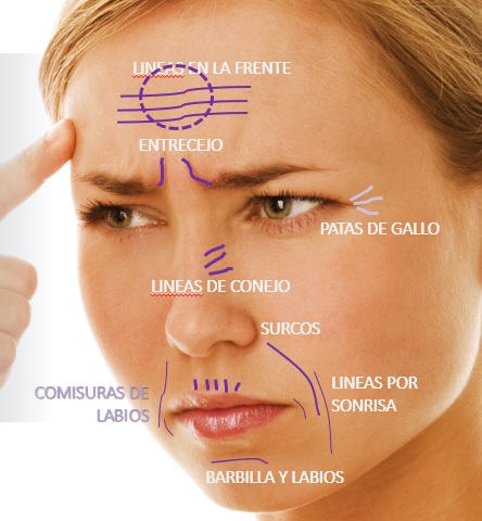 anti edad, arrugas, rejuvenecimiento, edad, lineas de expreson, disminuir lineas de expresion