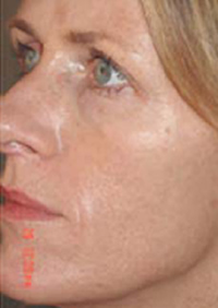 un buen dermatologo