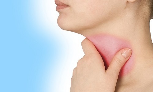 Болит горло после кальяна