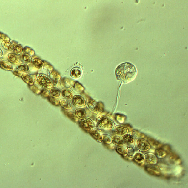 SIC EPISODE 95: PERYPHYTON AS A BIOINDICATOR OF WATER QUALITY