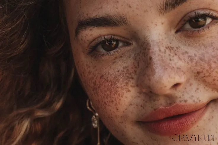 Adult Acne 101: Causes, Treatments, and Proven Solutions That Actually Work