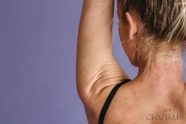 Guide to Period-Related Breakouts