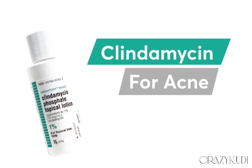 How Does Clindamycin for Acne Work?