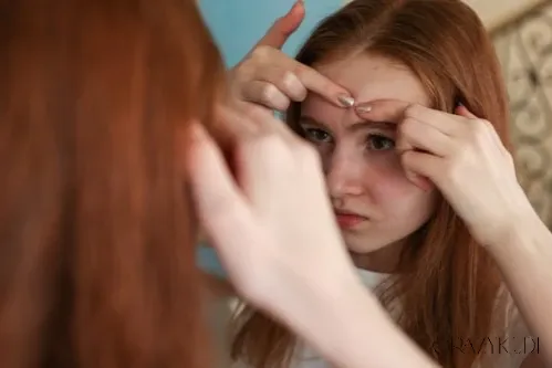 Why Am I Breaking Out? 8 Sneaky Causes of Acne (Plus How to Treat It)