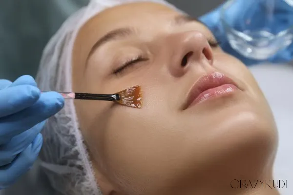Ready for Radiance? A Dermatologist Explains 6 Signs It Might Be Time for a Chemical Peel