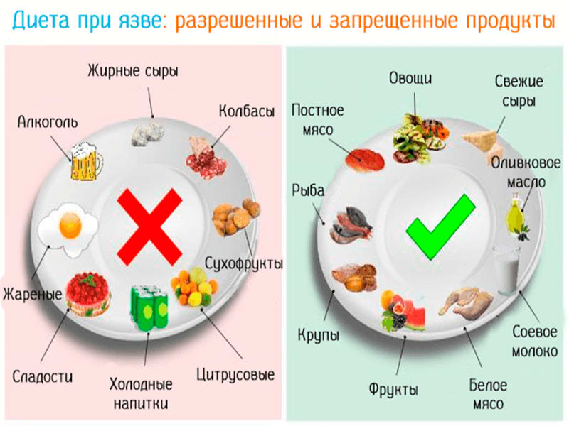 Разрешенные продукты во время диеты при язве желудка