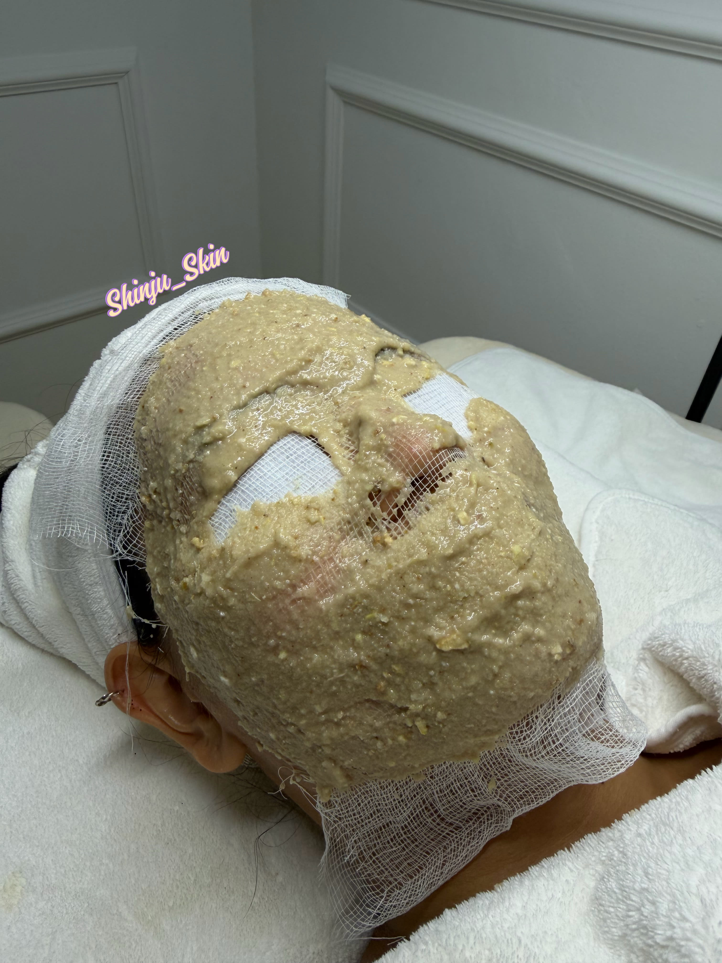 Post Treatment Glow