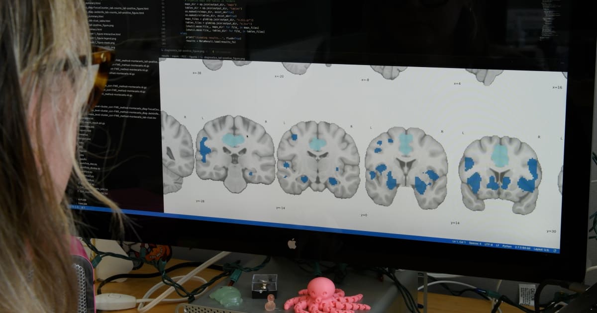 Photo: FIU Sleep Disorders Linked to Structural Brain Changes