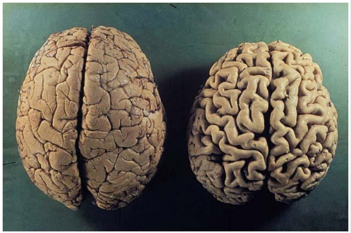 Your Brain is Under Attack—Here’s How to Heal and Protect It Before It’s Too Late