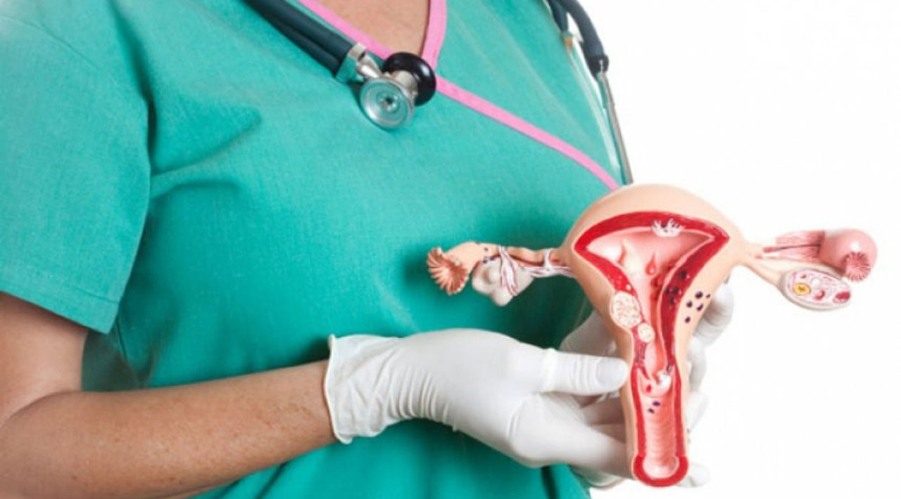 Ovarian Cancer Treatment Drains $218 Million from Nigerians Annually