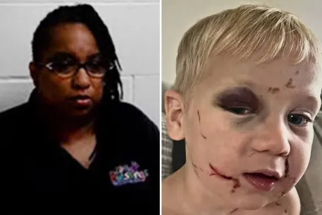 Georgia Daycare Worker Arrested After Toddler Suffers Black Eye and Swollen Face on First Day
