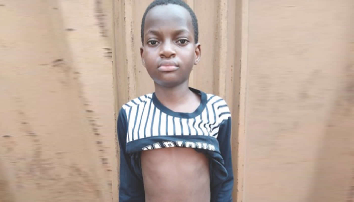 Family Appeals for N4m to Save 12-Year-Old Boy Needing Corrective Surgery