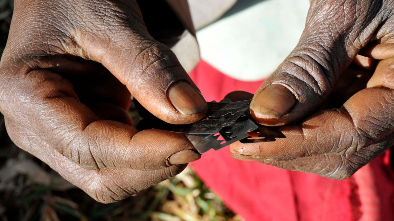Nigeria Ranks 3rd Globally in Female Genital Mutilation with 20 Million Victims – UNICEF
