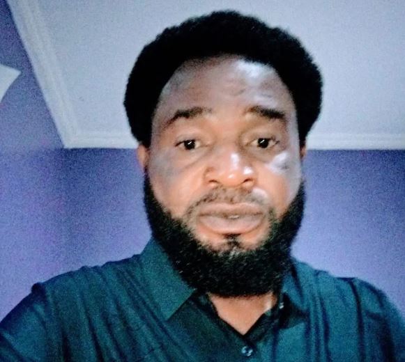 ADC Deputy Spokesperson in Imo Slumps and Dies Suddenly