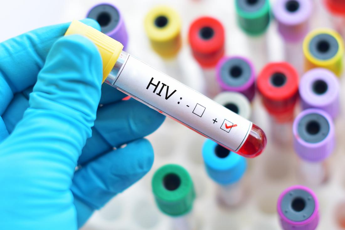 Over 160,000 Lagos Residents Living With HIV — State Government