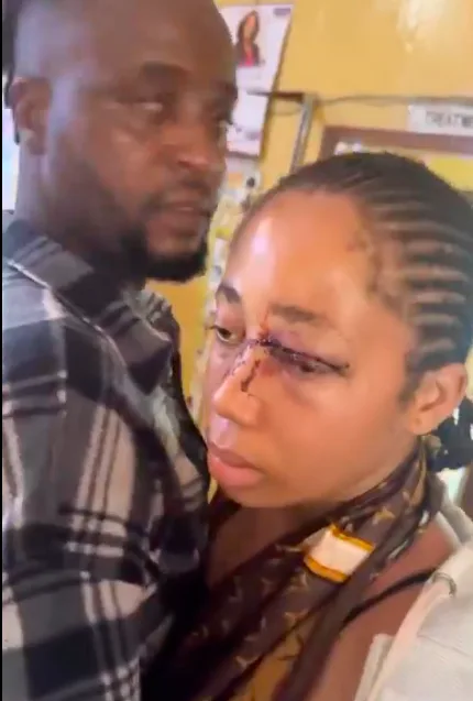 Suspect in Viral Abuse Video Arrested, 18-Year-Old Treated as Child — Activist