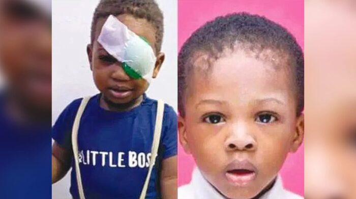 NDLEA Shooting: Family calls for probe, demands medical funds for surviving son