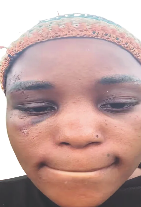 How I Escaped After Gunmen Abducted 16 Victims – Hairstylist
