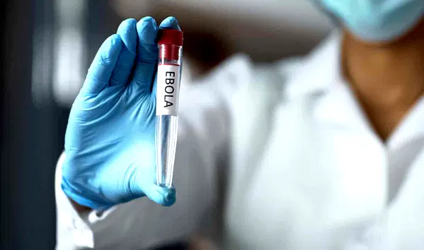 Nigeria Confirms First Case Of Bundibugyo Ebola Strain