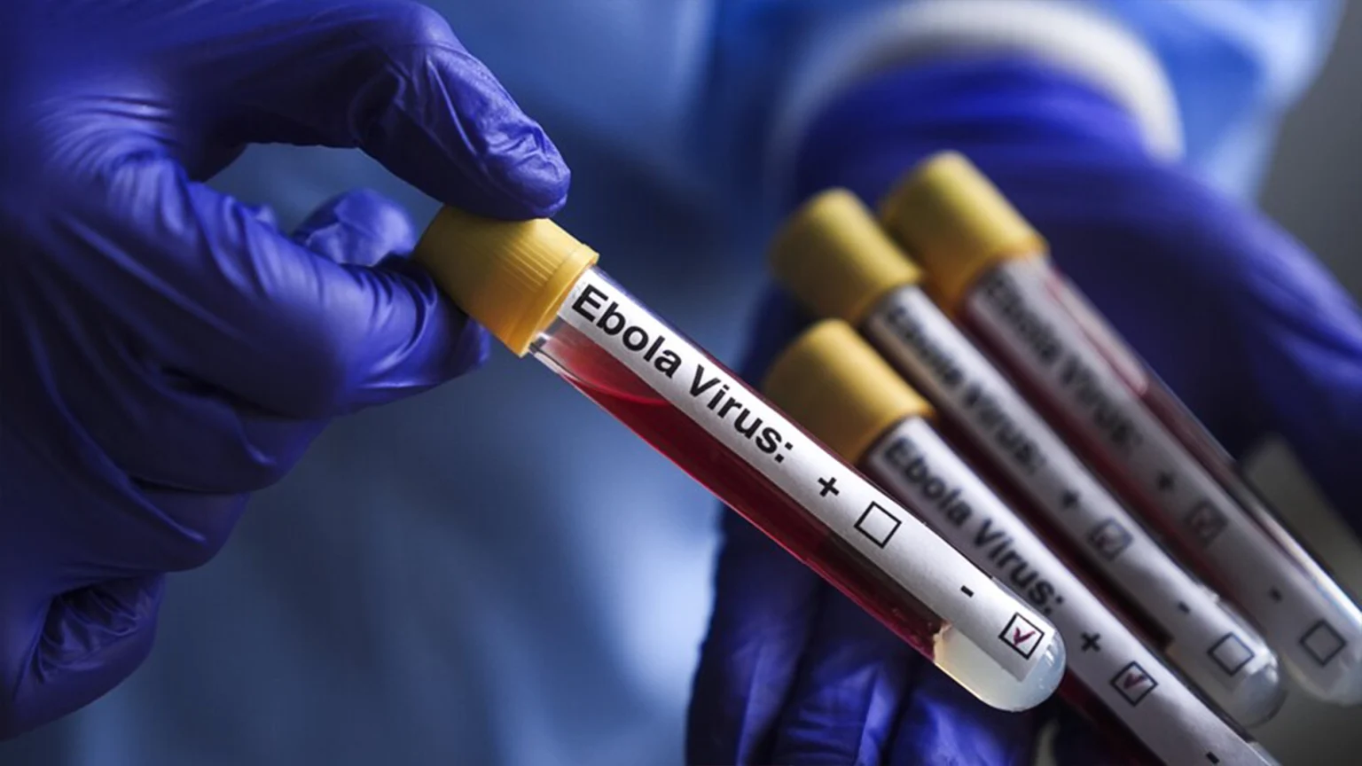 Ebola: Nigeria to evacuate Ugandan patient from Abuja