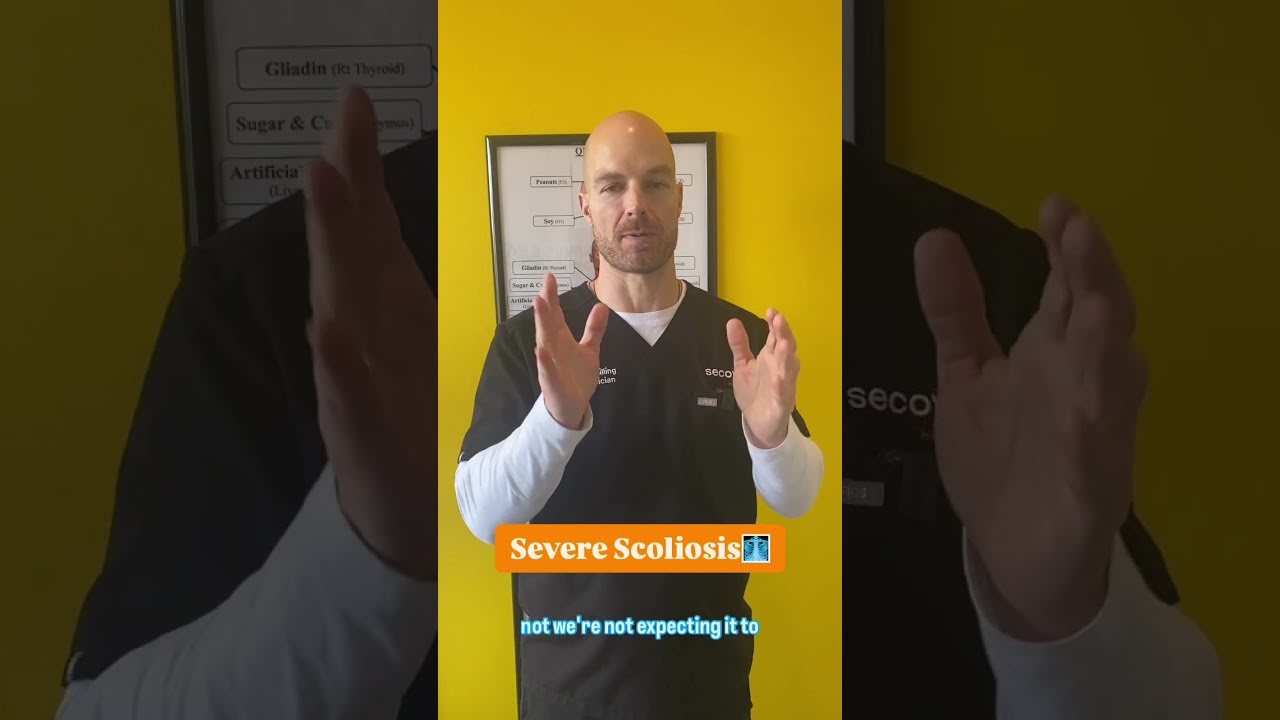 Severe Scoliosis