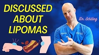 Dr. Schilling Discussed About Lipomas