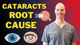 How to Identify the Root Causes of Cataracts