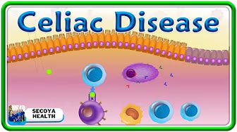Managing Celiac Disease: Brain Body Connection Explained