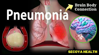Pneumonia Brain Body Connection And Managing the Brain-Body Connection in Pneumonia