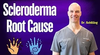 Scleroderma Root Cause 🤚🏽 And Managing Scleroderma: A Guide to Root Causes