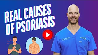 What Are the Real Causes of Psoriasis? 😣